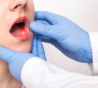 Cancer de la gorge et la bouche